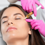 PRP Therapy