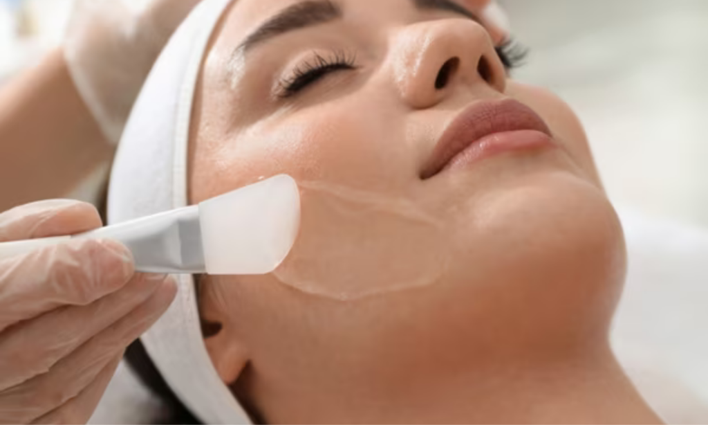 chemical peel treatments