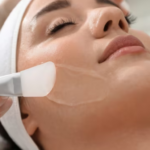 chemical peel treatments