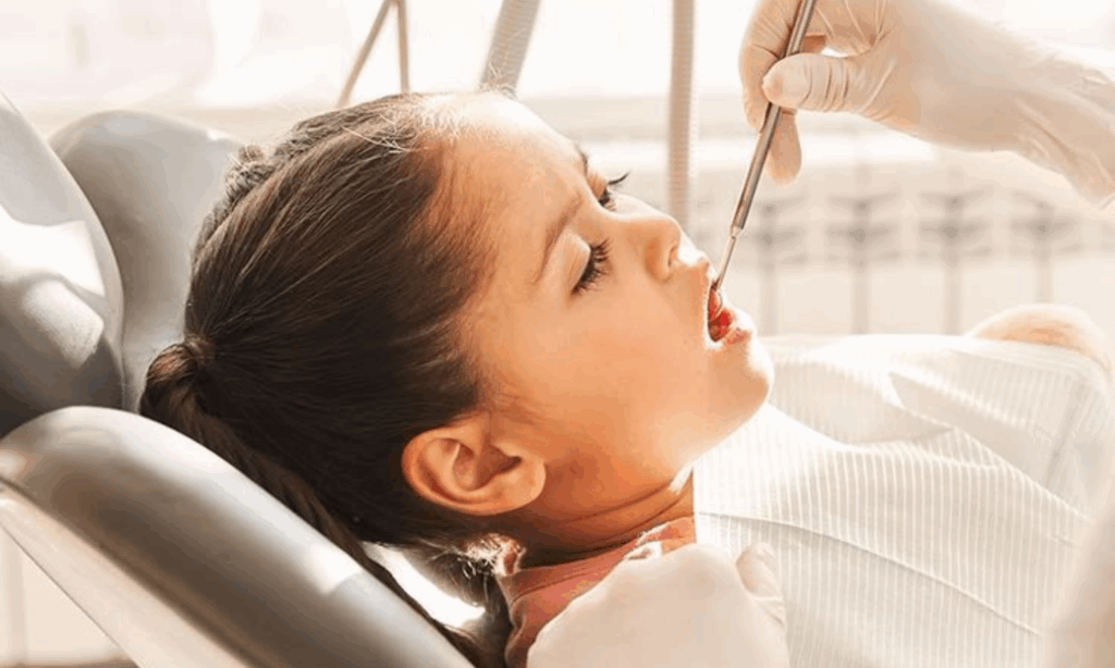 Fluoride Treatment